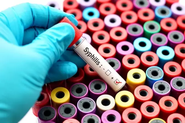 Understanding Syphilis in Singapore: Testing and Treatment