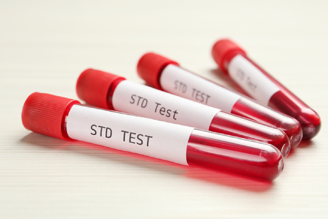 How Often Are People in Singapore Getting Tested for STDs?