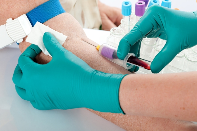 How To Thoroughly Prepare For Your Upcoming Blood Test