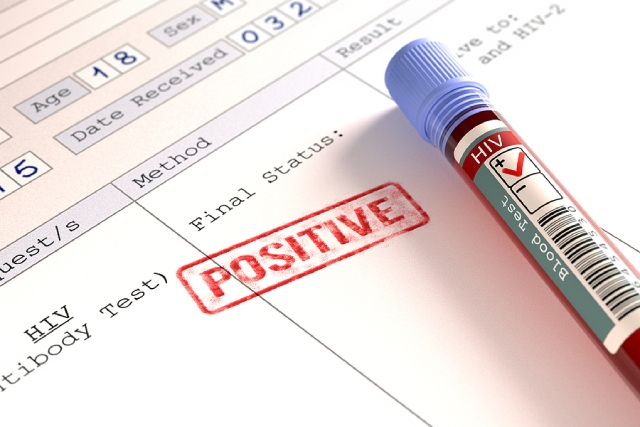 166 New HIV Cases in Singapore: Why You Should Get Tested Now