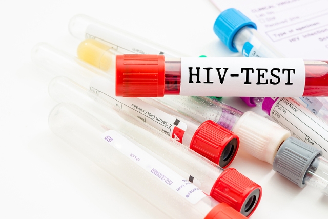 Anonymous HIV & STD Testing: How It Works & Where to Go