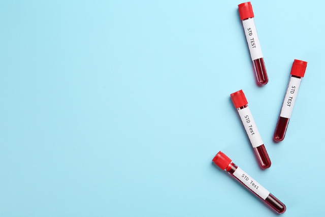 Choosing the Right STD Test: Comprehensive Panels Explained