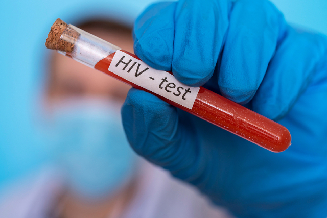 HIV Testing Before National Service: What NSFs and Enlistees Should Know