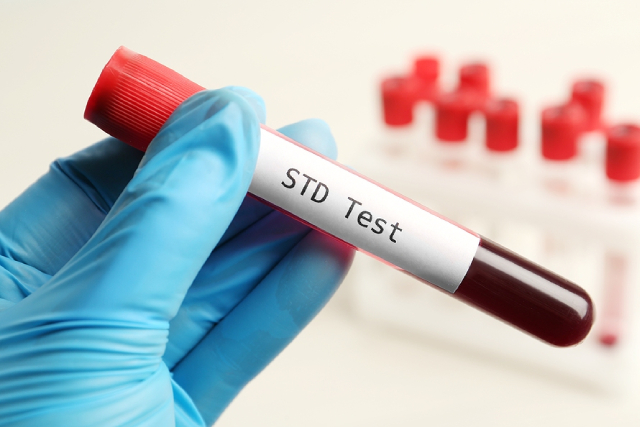 STD Testing Costs in Singapore 2026: A Transparent Price Breakdown by Test Type